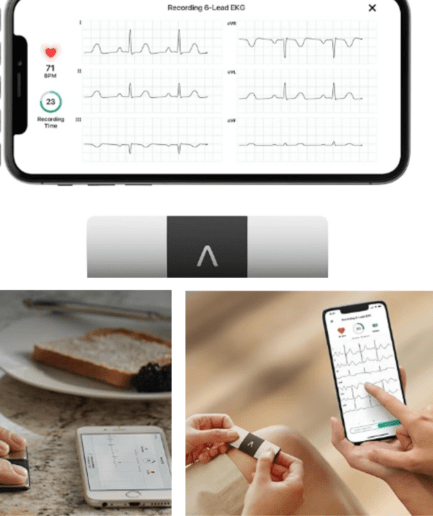 KardiaMobile 6-Lead EKG