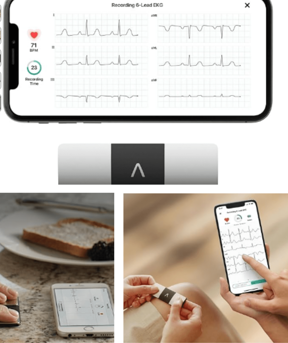 KardiaMobile 6-Lead EKG